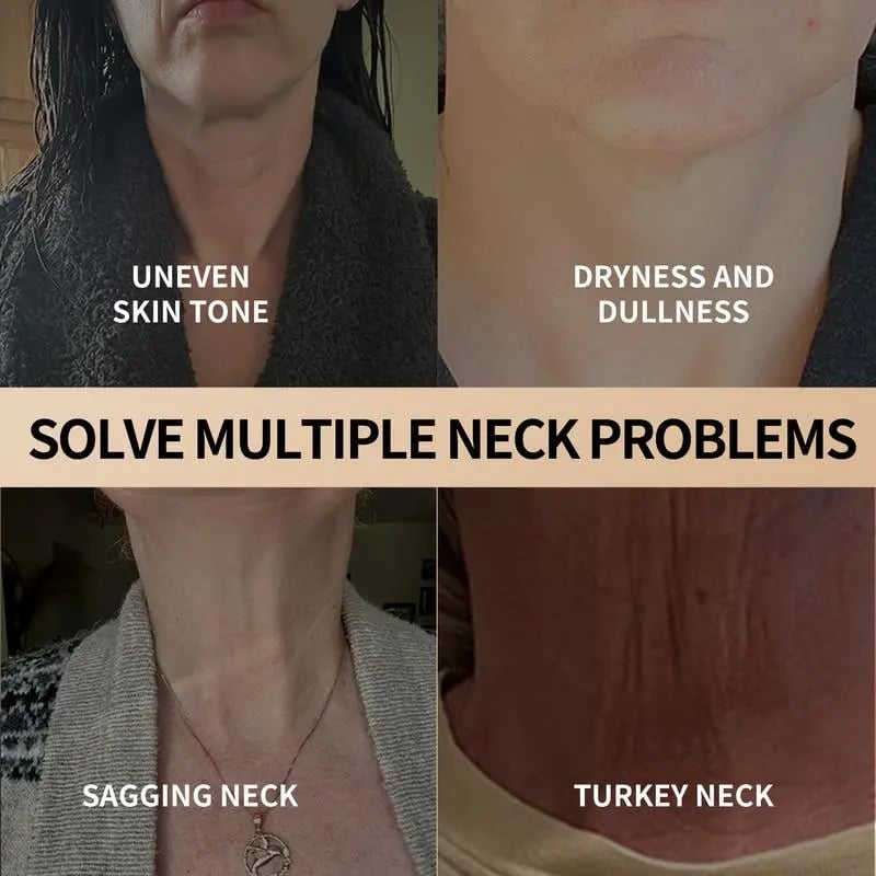 ✨Hot Sale 49% OFF🔥Only $12.99 Today!!!🎉-YCZ Neck Cream