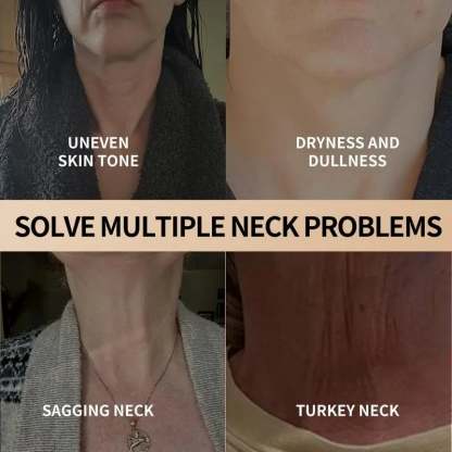 ✨Hot Sale 49% OFF🔥Only $12.99 Today!!!🎉-YCZ Neck Cream