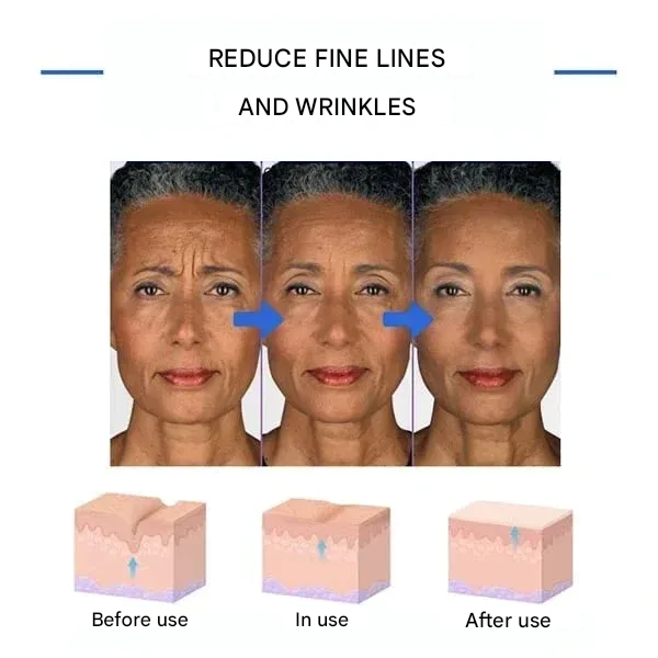 🔥 Last Day Sale 49% OFF - Anti-wrinkle Refiner