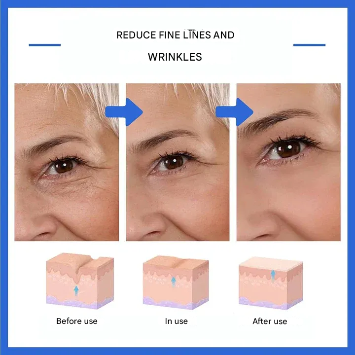 🔥 Last Day Sale 49% OFF - Anti-wrinkle Refiner