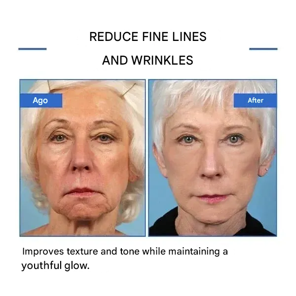 🔥 Last Day Sale 49% OFF - Anti-wrinkle Refiner