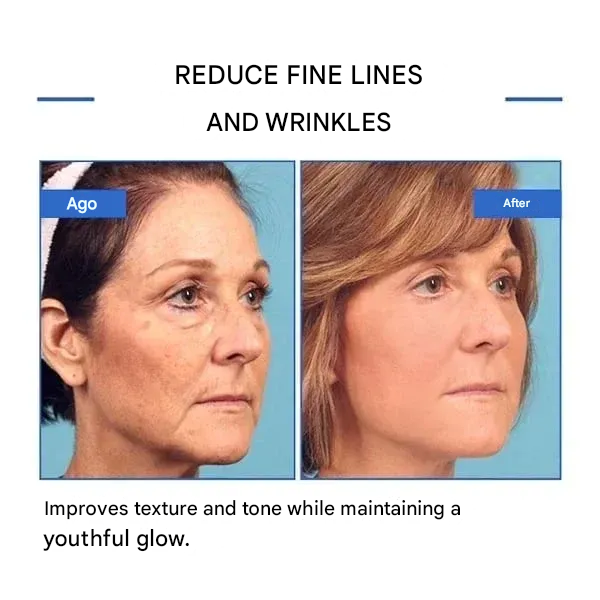 🔥 Last Day Sale 49% OFF - Anti-wrinkle Refiner