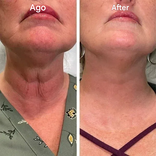 🔥 Last Day Sale 49% OFF - Anti-wrinkle Refiner