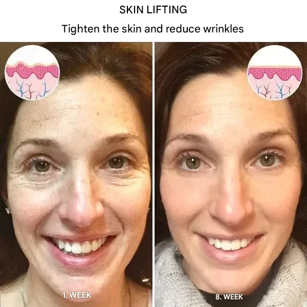 🔥 Last Day Sale 49% OFF - Anti-wrinkle Refiner