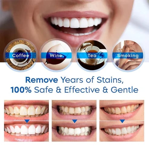 🔥Last Day Promotion 49% OFF🔥-Teeth Whitening Essence