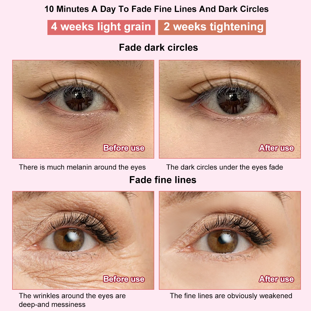 Shenzhen JYK Wholesale Eye Facial Beauty Massager Ems Vibration Eye Led Red Light Massager Wand With Heat Compression