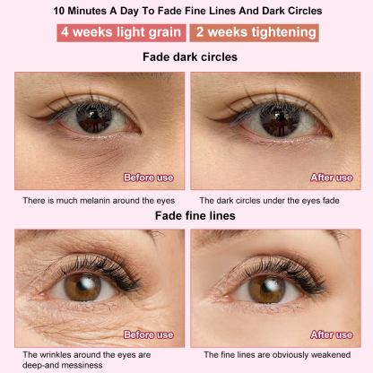 Shenzhen JYK Wholesale Eye Facial Beauty Massager Ems Vibration Eye Led Red Light Massager Wand With Heat Compression