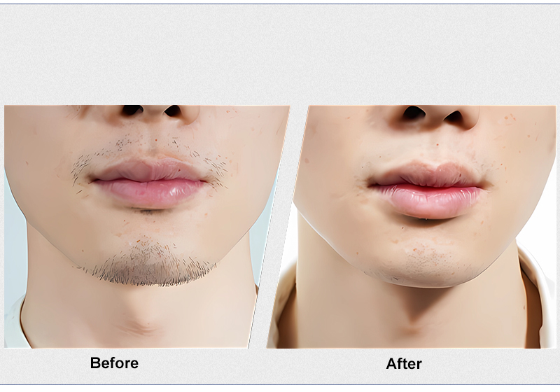 {"default":"multi function beauty instrument"}