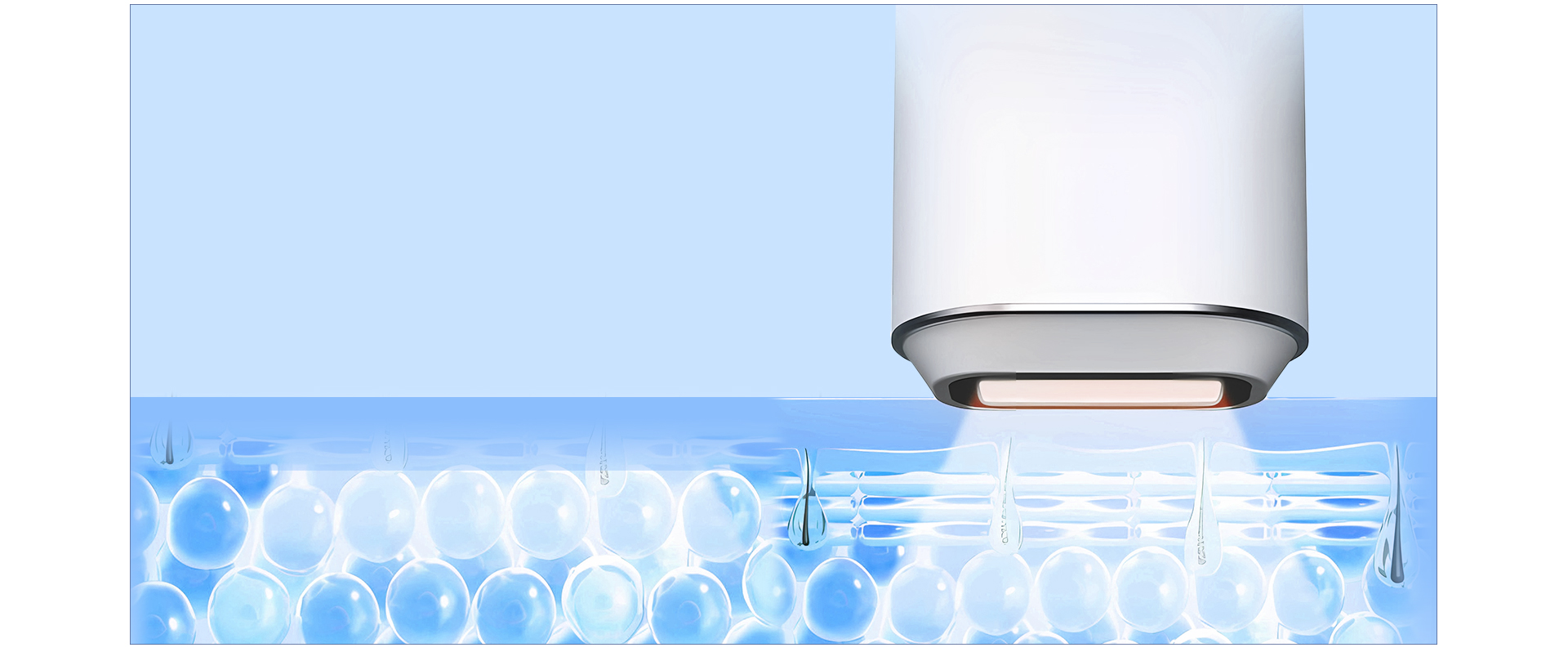 {"default":"best at home hair laser"}