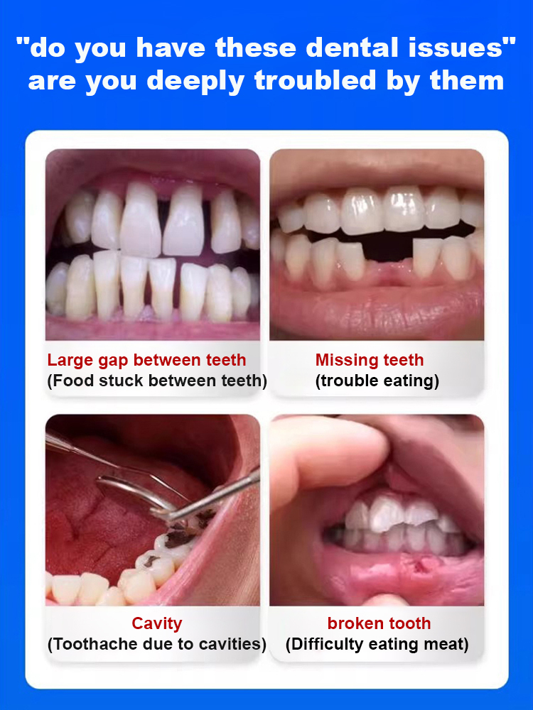 Thermal Forming Dentures – Fix Teeth at Home Easily, Master in 1 Minute! 😊 100% Natural Material, FDA Approved ✅