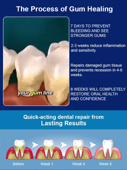 Over 100,000 users have proven its effectiveness! Gum Repair Gel – no surgery, no prescription, money-back guarantee if ineffective✅