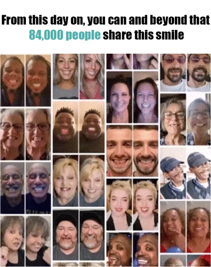 No Dentist Visit Needed! 😁 Custom Fit in 3 Mins! 🕒 Medical-Grade Silicone Dentures ✅ 180-Day Warranty & Refund Guarantee!