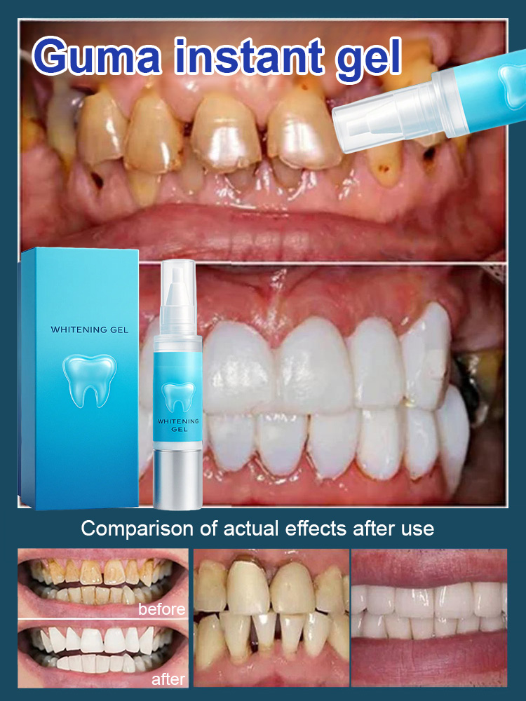 Over 100,000 users have proven its effectiveness! Gum Repair Gel – no surgery, no prescription, money-back guarantee if ineffective✅