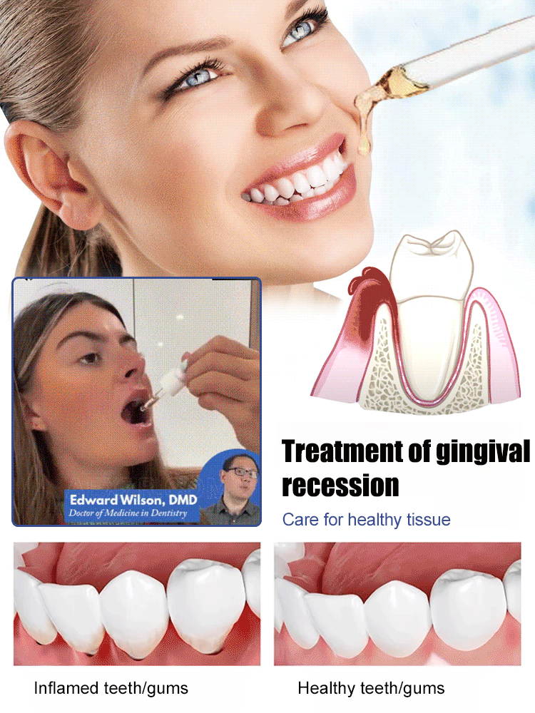 3-in-1 Tooth Regeneration Care Drops – Restores Gums, Whitens & Stops Sensitivity