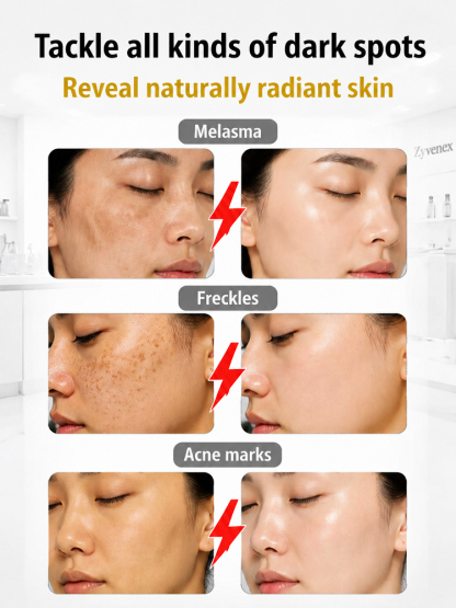 7-in-1 Melanin-Targeting Brightening Serum – Fades Spots, Hydrates & Restores Radiance