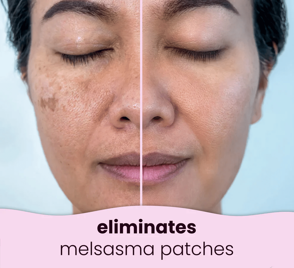 🎁LAST DAY 49% OFF🔥Turmeric Kojic Acid Cleansing Pads