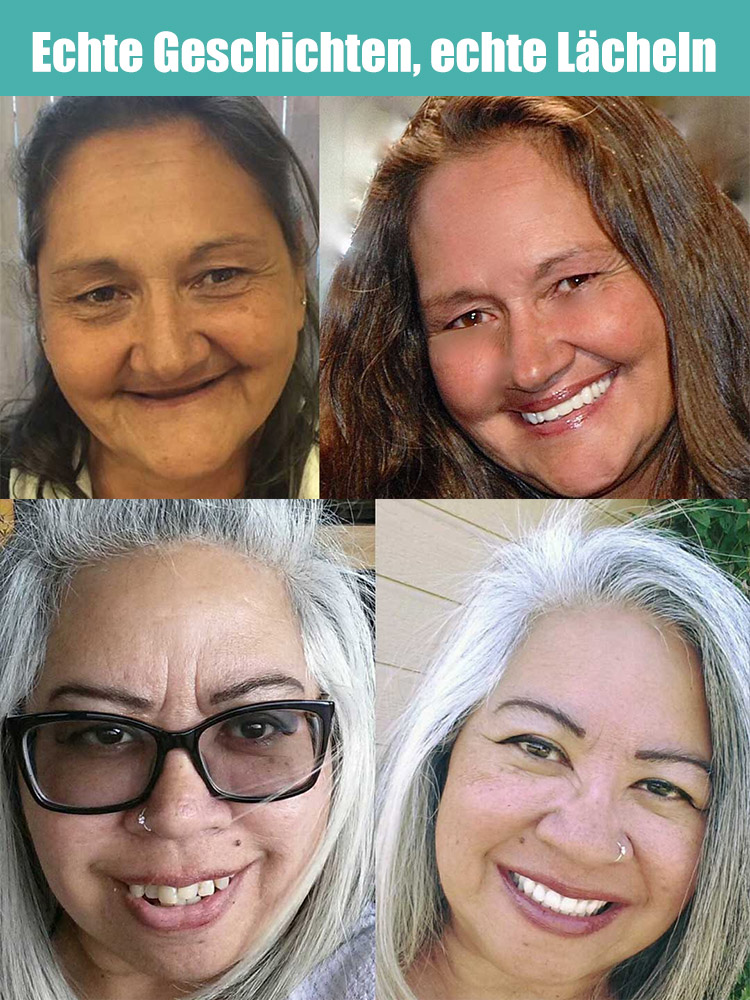 🦷✨Holen Sie sich Ihr strahlendes Lächeln zurück – ganz ohne teure Zahnarzttermine!