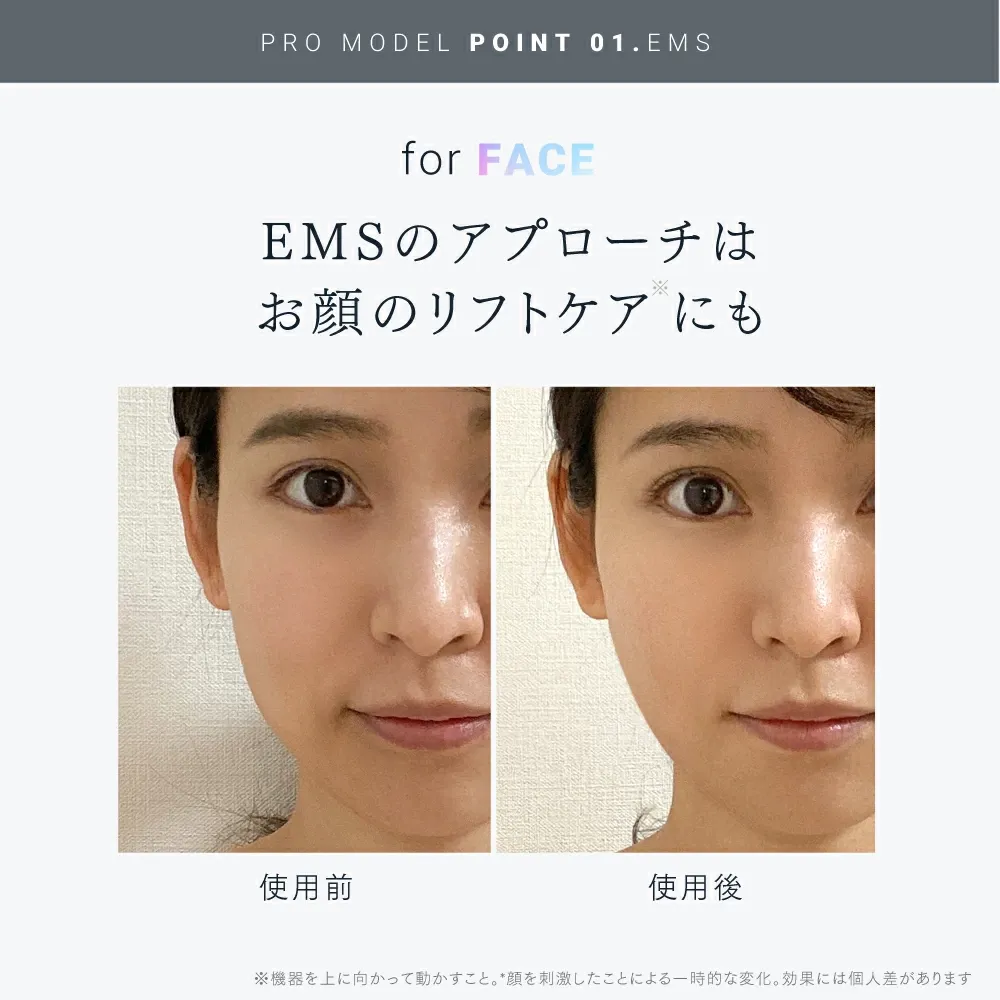【公式｜期間限定 5%OFFクーポン+P5倍！】最高峰※ EMSヘッドスパ 頭皮 ヘッドマッサージ EMS 赤色LED 機能搭載【公式】 MYTREX EMS HEAD SPA PRO マイトレックス プロ フェイスケア リフトケア 頭皮ケア 電動頭皮ブラシ スカルプ スパ 美容