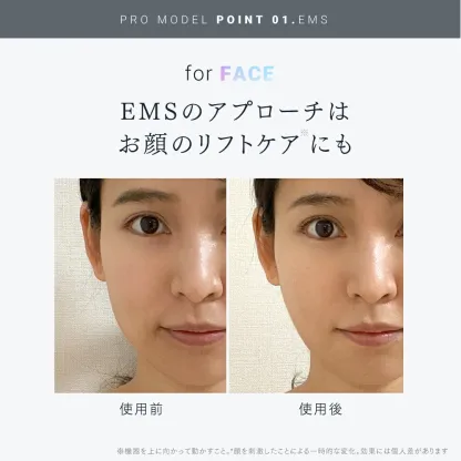 【公式｜期間限定 5%OFFクーポン+P5倍！】最高峰※ EMSヘッドスパ 頭皮 ヘッドマッサージ EMS 赤色LED 機能搭載【公式】 MYTREX EMS HEAD SPA PRO マイトレックス プロ フェイスケア リフトケア 頭皮ケア 電動頭皮ブラシ スカルプ スパ 美容