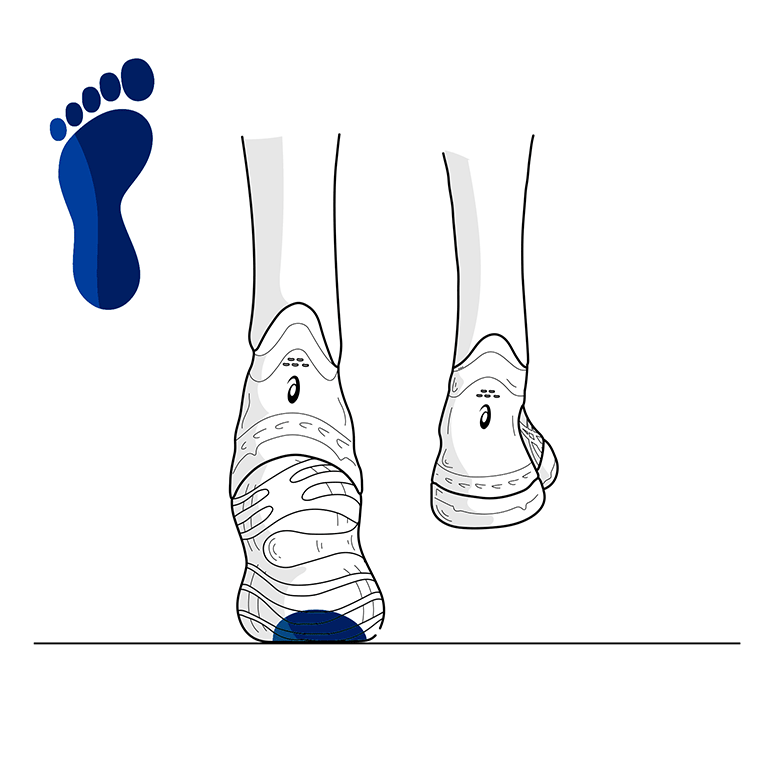 pronation-type-neutral