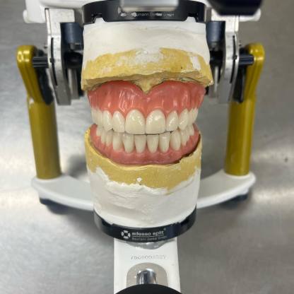 Easy Denture™ kerámia kompozit szilikon állítható univerzális fogpótlás