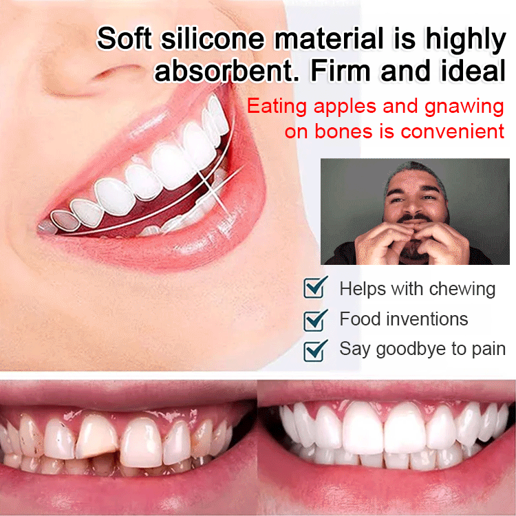 SorriBem Perfect Smile Dentures