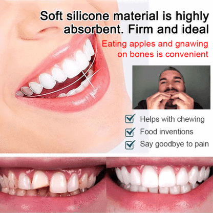 SorriBem Perfect Smile Dentures