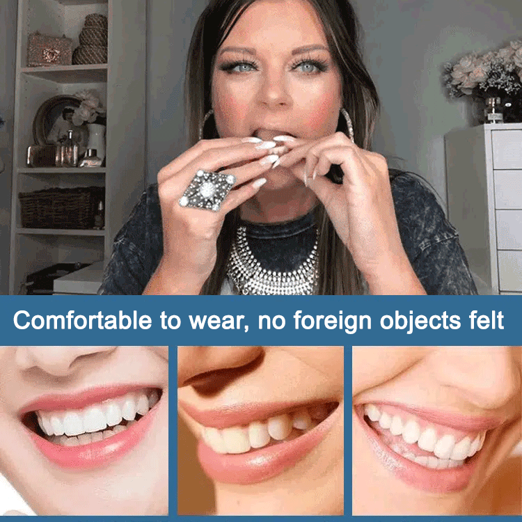 SorriBem Perfect Smile Dentures