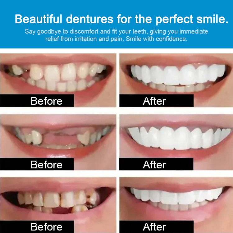 SorriBem Perfect Smile Dentures