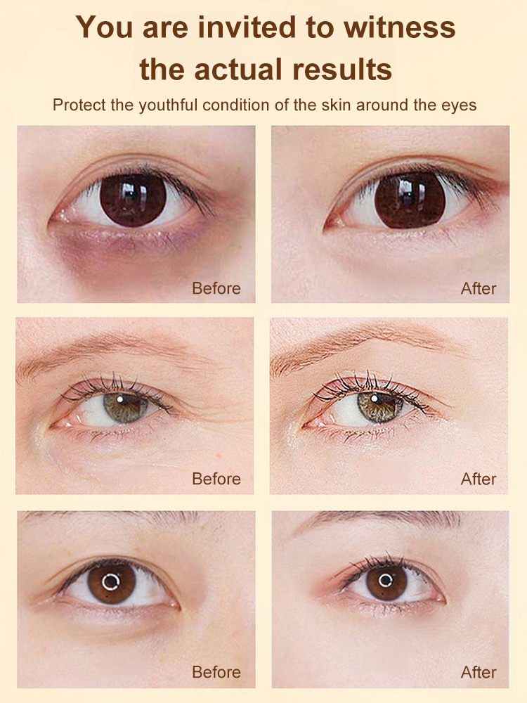 Just 5 days! Say goodbye to eye bags and wrinkles around the eyes!