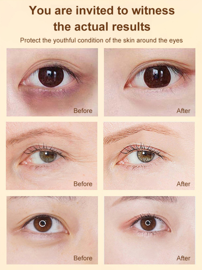 Just 5 days! Say goodbye to eye bags and wrinkles around the eyes!