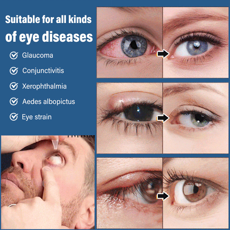 Anti-fatigue Eye Drops