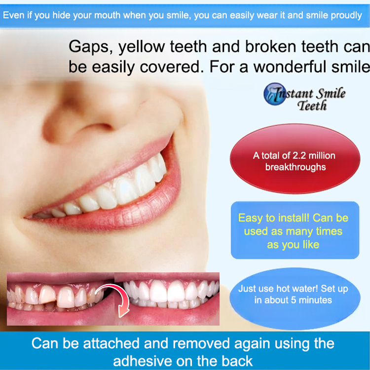 SorriBem Perfect Smile Dentures