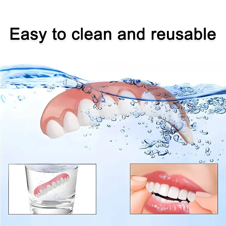 SorriBem Perfect Smile Dentures