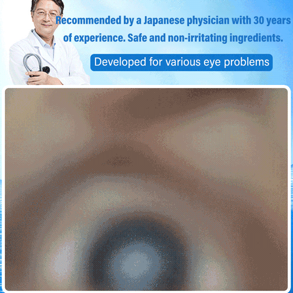 Anti-fatigue Eye Drops