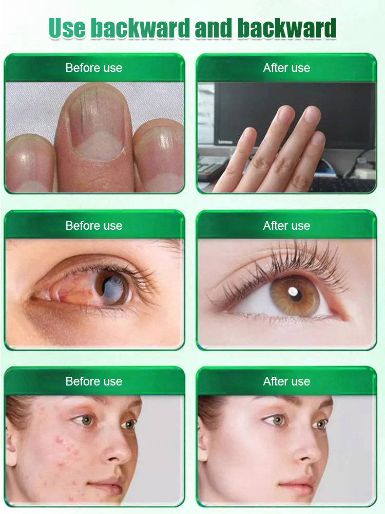 🌿 Is your liver tired? Late nights, social events, greasy takeout... Have you noticed the "invisible stress" on your liver?