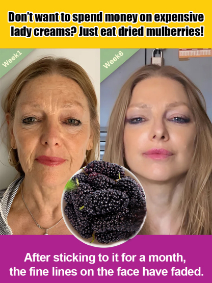 【Zero pollution, zero additives, dried mulberries 】🎉Royal Supplement: Natural Wild Mulberry Fruit Dry. A boost for men, a beauty salon for women.