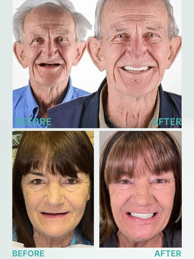 Soft silicone fits any denture 😊, offering wear as comfortable as real teeth 🦷. These mouthguards are used in renowned European dental clinics 🏥 and are now 50% off 🎉