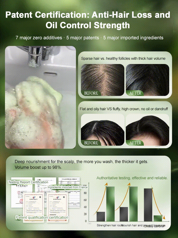 Natural plant soap shampoo, prevents hair loss, relieves itching, controls oil, and promotes thick, strong hair growth.