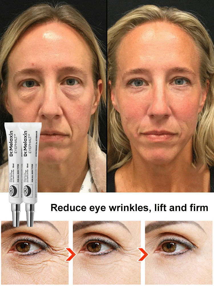 【Eliminate wrinkles in 30 seconds!】Anti-wrinkle essence eye cream