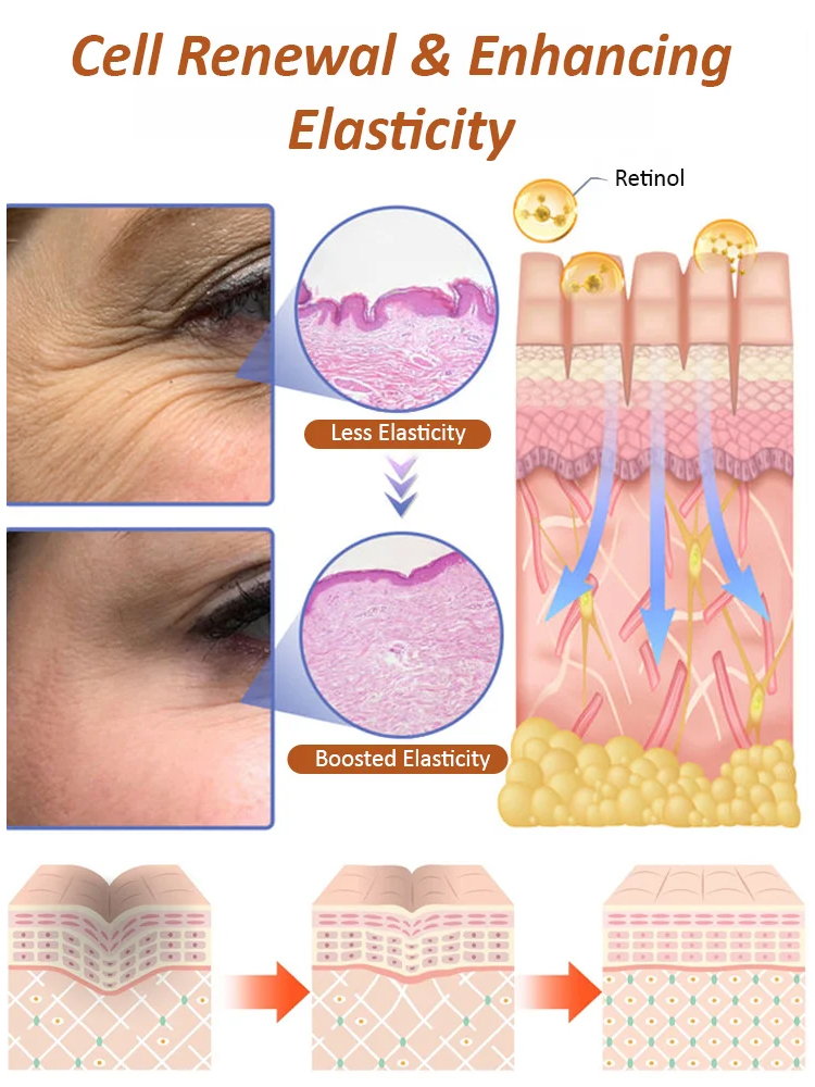 【Eliminate wrinkles in 30 seconds!】Anti-wrinkle essence eye cream