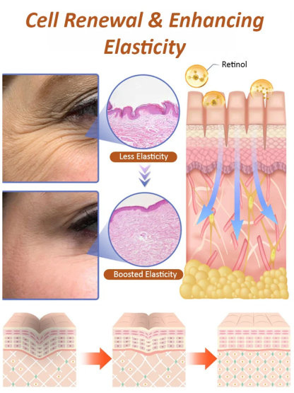 【Eliminate wrinkles in 30 seconds!】Anti-wrinkle essence eye cream