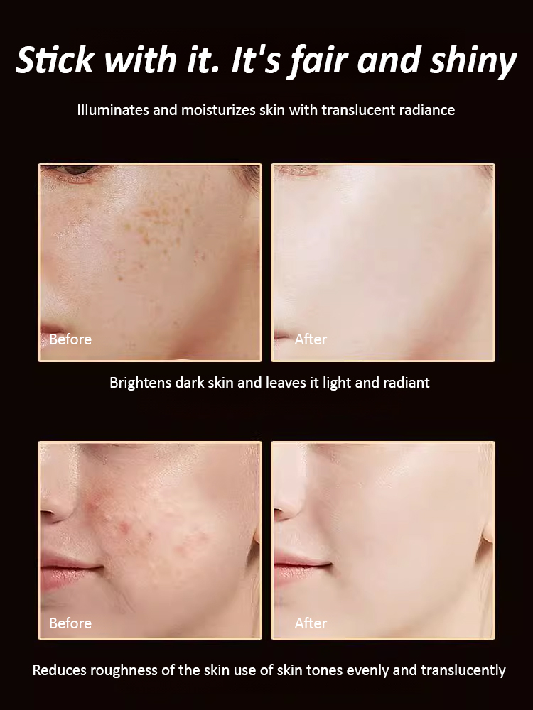 【15-day freckle removal】377 Whitening and freckle removal water light mask