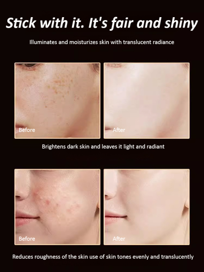 【15-day freckle removal】377 Whitening and freckle removal water light mask