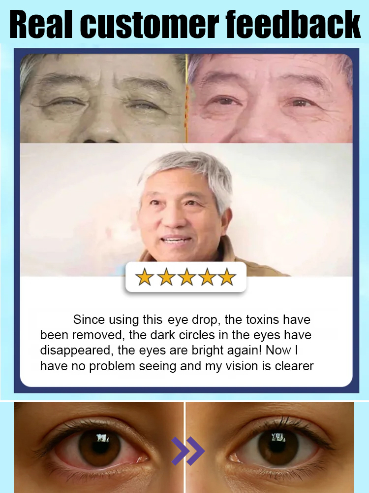 Blueberry Eye Moisturizing Cooling Gel for Dry Eyes