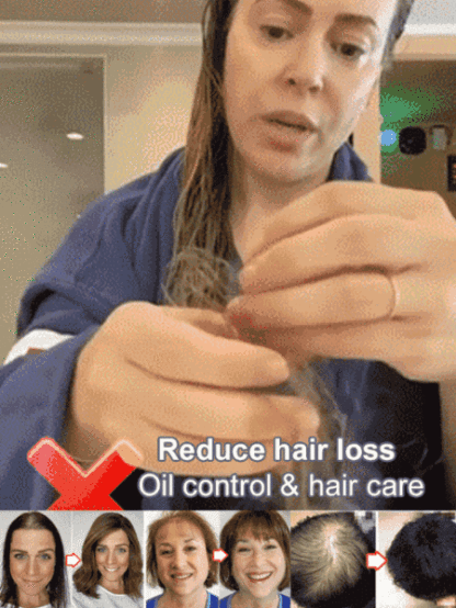 Hot Sale Ginger Plant Extract Anti-Hair Loss Hair Shampoo