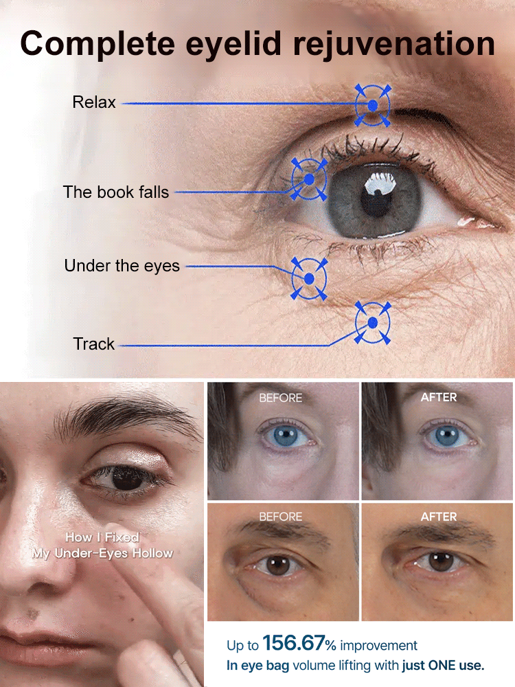 【Eliminate wrinkles in 30 seconds!】Anti-wrinkle essence eye cream