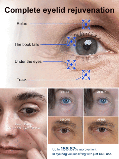 【Eliminate wrinkles in 30 seconds!】Anti-wrinkle essence eye cream