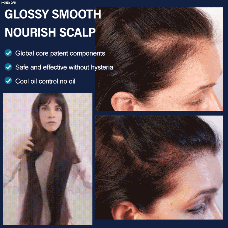 New upgrade version - Hair Growth Serum, boost your hair grows faster