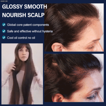 New upgrade version - Hair Growth Serum, boost your hair grows faster